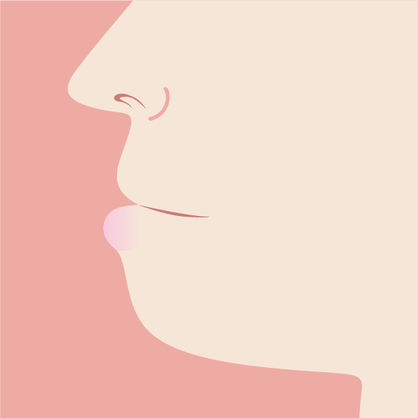 受け口のイメージ画像