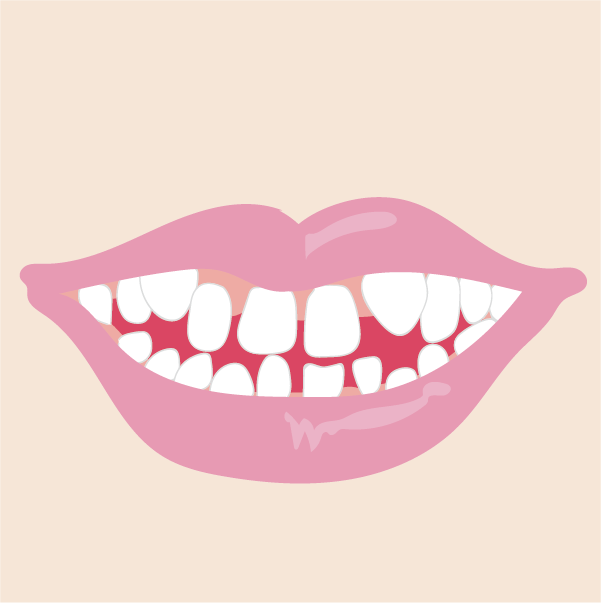 オープンバイトのイメージ画像