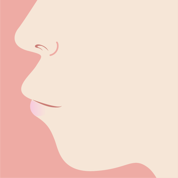 出っ歯のイメージ画像