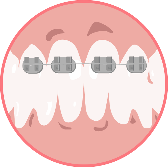 部分矯正のイメージ画像